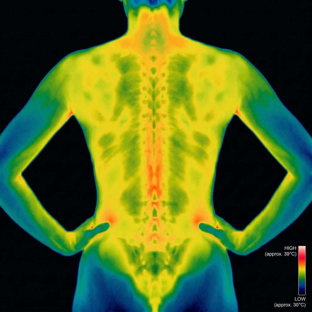 Thermal imaging after