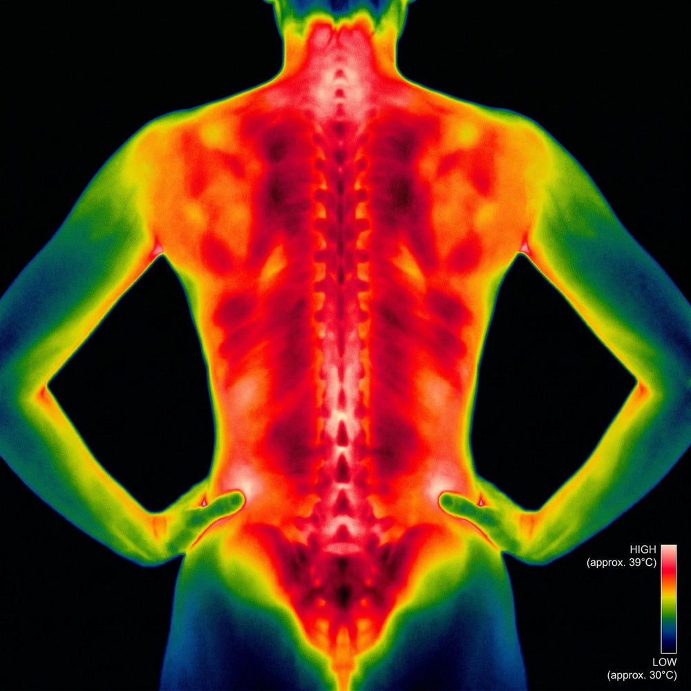 Thermal imaging baseline